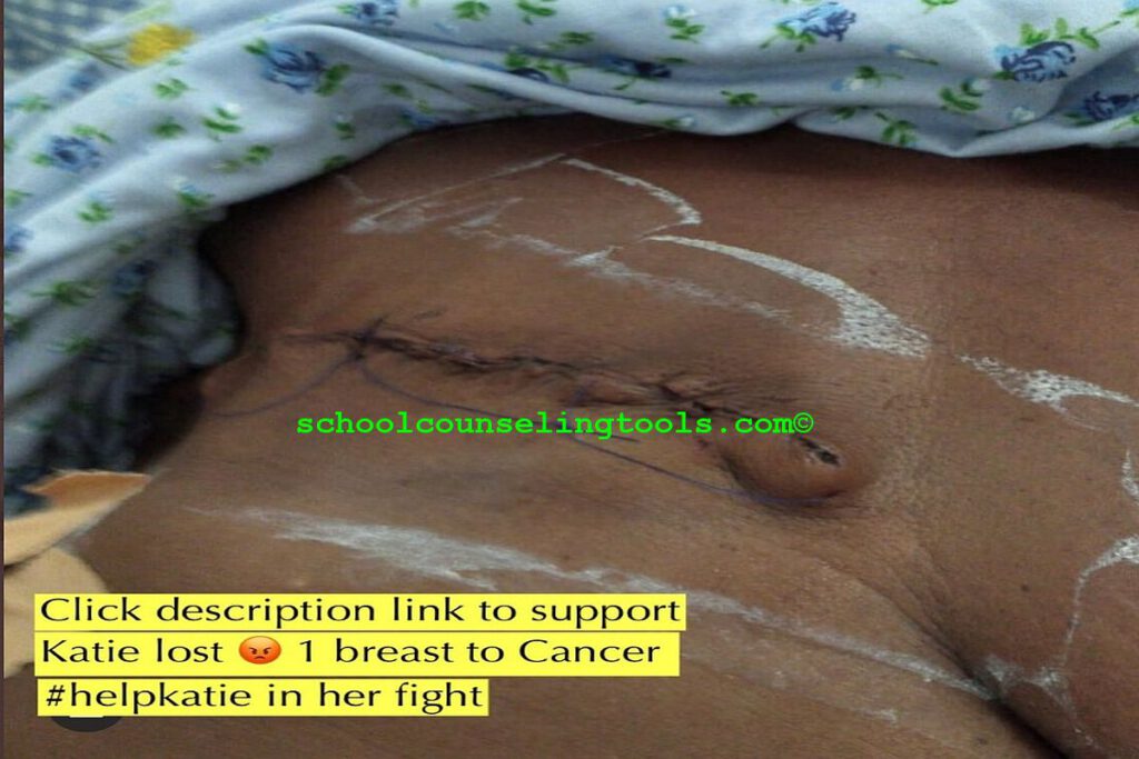 Cancer Survivor
#cancersurvivor